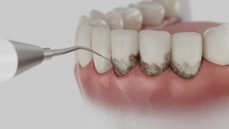 Trusted Dental Implants service in Ettrick, VA - Dentist Open Now